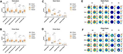 Antidepressant effect of bright light therapy on patients with Alzheimer’s disease and their caregivers